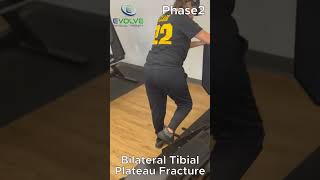 Bilateral Tibial Plateau Fractures Improving Hip and Knee Strength  Advanced Exercises [upl. by Asiralc100]