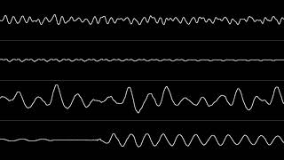 SNES Equinox Tori  Oscilloscope View [upl. by Anerac]