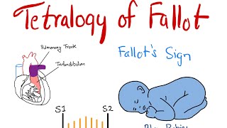 Updated Video Available Endoscopic Endonasal Pituitary and Skull Base Surgery [upl. by Adnovay]