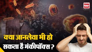 Monkey Pox Virus in India क्या है मंकीपॉक्स के लक्षण  इलाज न कराए तो क्या होगा   WHO Warning [upl. by Aihsekal]