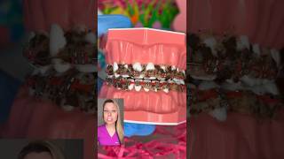 How to FLOSS with BRACES after eating EASTER CANDY 🐣 braces easter candy [upl. by Hach]