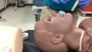 Oropharyngeal airway insertion [upl. by Minnie]