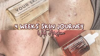 4 Minggu Pakai Avoskin Your Skin Bae  Tekstur Kulit Gradakan amp Bekas Jerawat Wajib Coba [upl. by Gurl]