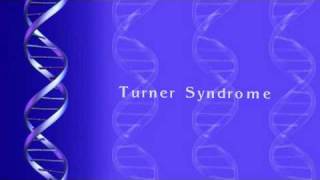 Turner Syndrome [upl. by Satterlee235]