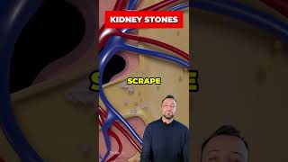 Why do you have BLOOD in your URINE shorts bloodinurine health [upl. by Derk514]