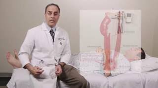 Iliotibial Band Syndrome Physical Exam  Stanford Medicine 25 [upl. by Crichton]