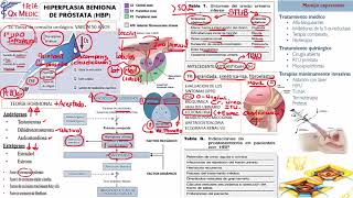 1 HIPERPLASIA BENIGNA DE PROSTATA [upl. by Lexie227]