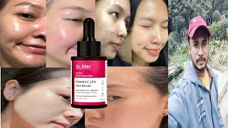 Dr alies vitamin c 15 face serum  honest review [upl. by Montana115]