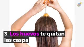 ¿Cómo eliminar la caspa 5 tratamientos para la caspa que te dejan el pelo hermoso Remedios caseros [upl. by Evelyn]