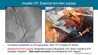 Out on a Limb Vascular Access Management with ECMO and Impella [upl. by Latrina]