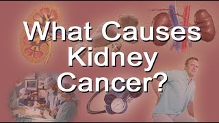 What Causes Kidney Cancer [upl. by Ainesey590]