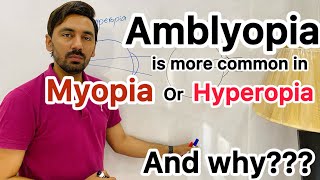 Amblyopia more common in hyperopia or Myopia and Why [upl. by Yldarb]