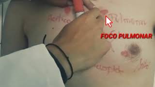 FOCOS AUSCULTATORIOS CARDÍACOS DEMO [upl. by Sellig]