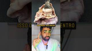 Teratomao tumor que pode ter dentes e cabelo🦷💇‍♀️😱 tumores biologia medicina curiosidades [upl. by Marden]