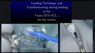 Visian EVO ICL loading and troubleshooting situations while loading  for the novice [upl. by Oibirot]