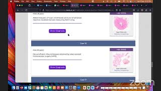 FRCPath 2 Histopathology Short Surgical Past cases discussion [upl. by Atnuhs]