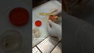 Gall bladder specimen cutting 🧐👀 [upl. by Trojan]