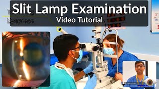 Slit Lamp Exam Tutorial  Part 1 [upl. by Bevis]