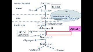 【Exercise】Galactose Metabolismstabilize your knowlegde【USMLE】 [upl. by Sollows]