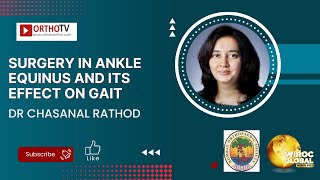 Surgery in Ankle Equinus and its Effect on Gait  Dr Chasanal Rathod [upl. by Rosemonde378]