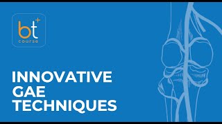 Course Preview Innovative Genicular Artery Embolization Techniques Two Case Studies [upl. by Reviel]