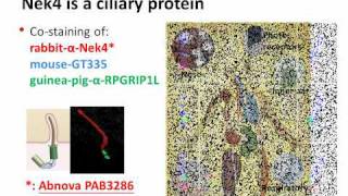 The Ciliopathyassociated Protein Homologs RPGRIP1 [upl. by Hewet]