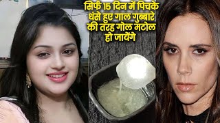 सिर्फ 15 दिन में पिचके धंसे हुए गाल गुब्बारे की तरह गोल मटोल हो जायेंगे How to Get Chubby Cheeks [upl. by Elaina910]