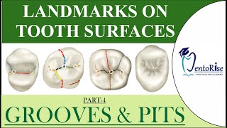 Landmarks on tooth surfaces Part4 GROOVES  PITS  Terminology  Tooth landmarks  Dental Anatomy [upl. by September753]