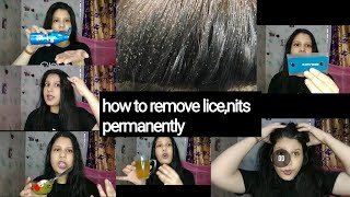 How to remove Lice nits from hair permanentlyoilingwithcoconutoillicecombing and moreAnu Kumari [upl. by Llecrep165]