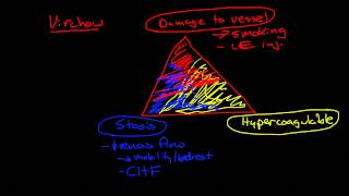 Thromboembolic Disease Deep Vein Thrombosis and Pulmonary Embolism [upl. by Frazier]