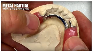 FULL PROCESS How to Make a Metal Partial with Attachments [upl. by Allwein]