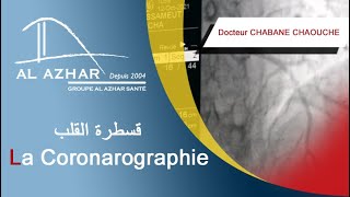 La Coronarographie قسطرة القلب [upl. by Rolland]