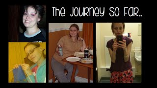 The Journey So Far  My IBD amp Ostomy Story  Thaila Skye [upl. by Gusba]