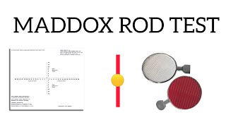 Maddox rod test  Principles  Thorington test  Made Easy [upl. by Didier]