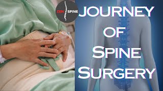 Undergoing Spine Surgery What To Expect [upl. by Ivonne]