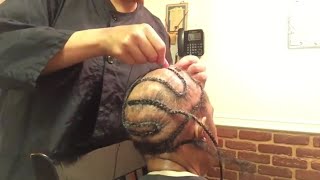 HAIR LOSS SEW IN [upl. by Maia435]