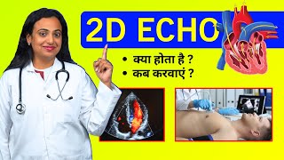 2D Echo Test for Heart  Kaise Hota Hai Kyu Kiya Jata Hai Echocardiography Test Procedure [upl. by Akinorev41]