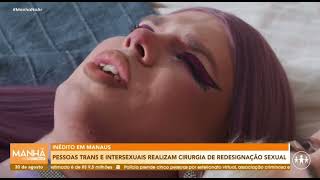 Pessoas Trans e Intersexo realizam cirurgia de redesignação sexual  Manhã no Ar  TV A Crítica [upl. by Alby]