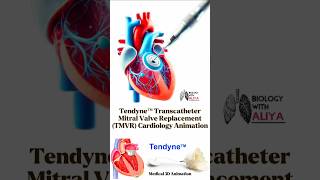 Tendyne™ Transcatheter Mitral Valve Replacement TMVR  Cardiology Animation 3d short [upl. by Scheld]