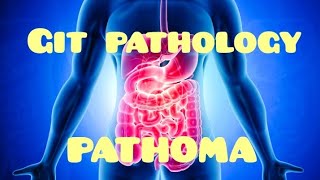 GIT PATHOMA 1Oral cavitySalivary glandsspecialpathology pathoma pathomalectures [upl. by Zenitram561]