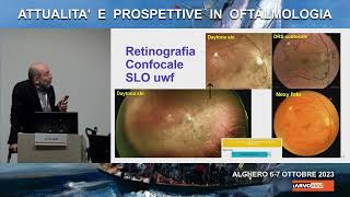 Retinopatia diabetica imaging intelligenza artificiale e telemedicina Alberto Di Bari [upl. by Saidnac611]