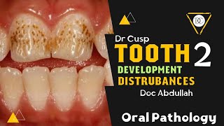 Tooth development distrubances Part 2quot Oral Pathology quot  Zagazig University [upl. by Sasnett]