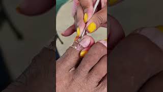 cleaning toenail videos nails pedicure satisfying [upl. by Alimat]