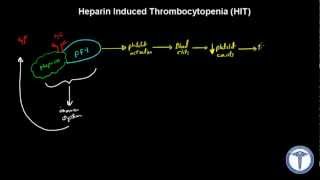 Heparin Induced Thrombocytopenia HIT Explained  MADE EASY [upl. by Claudell]