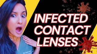 Halloween Gone Wrong Bacteria In Scary Contact Lenses  Costume Contact Lenses  Colored Contacts [upl. by Uhile]