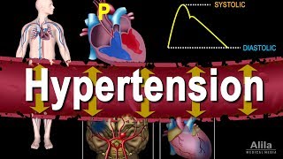 Hypertension  High Blood Pressure Animation [upl. by Aney781]