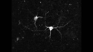 Dendritic Imaging with GCaMP6s in Awake Monkey [upl. by Cleaves]