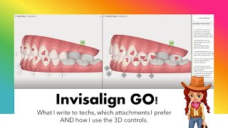 Invisalign GO ClinCheck amp case analysis [upl. by Jimmie]