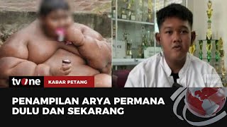 Masih Ingat Arya Bocah Obesitas Begini Sekarang Kondisinya  Kabar Petang tvOne [upl. by Suivart]