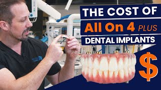 AllOn4 Same Day Dental Implants Cost At Dentaprime London [upl. by Lyda]